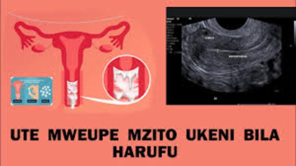 Sababu za Kutokwa na ute mweupe mzito ukeni