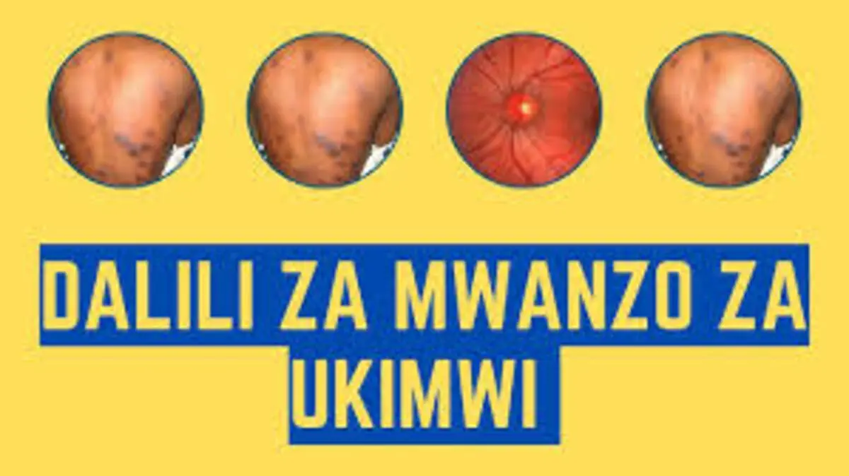 Dalili za mwanzo za ukimwi /VVU kwa mwanaume