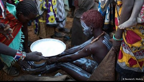 Madhara ya ukeketaji (Tohara kwa Wanawake)