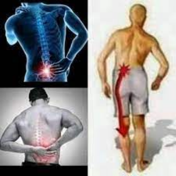 Kiuno kuuma husababishwa na nini? Fahamu chanzo na Tiba Madhubuti Kiuno kuuma husababishwa na nini? Fahamu chanzo na Tiba Madhubuti