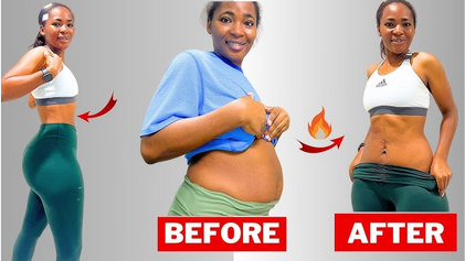 Jinsi ya kurudisha tumbo baada ya kujifungua kwa operation
