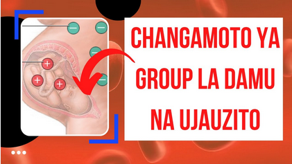 Group o negative kwa mjamzito