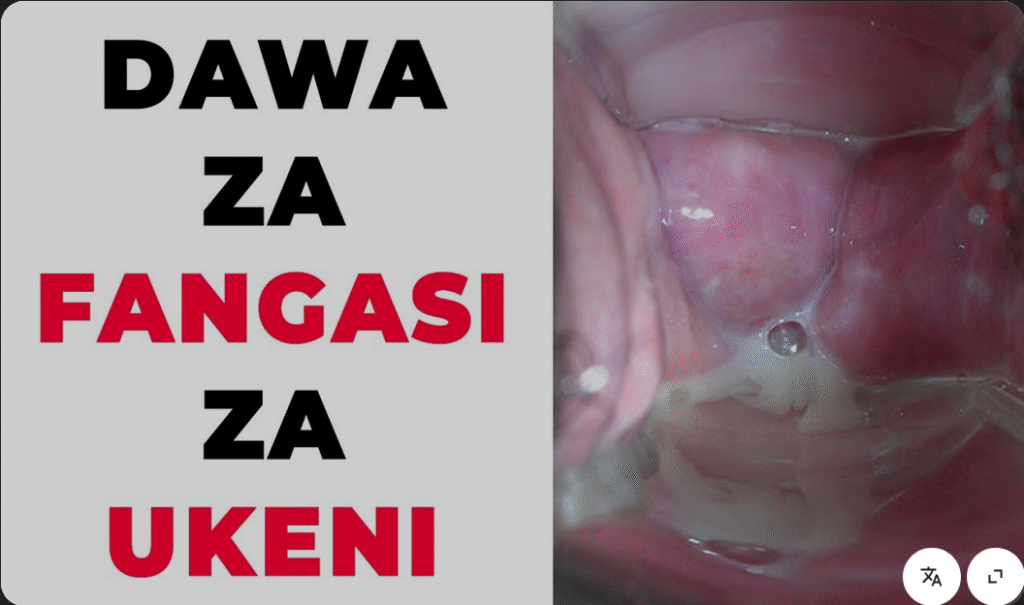 Jinsi ya KUTUMIA kitunguu saumu kutibu fangasi ukeni