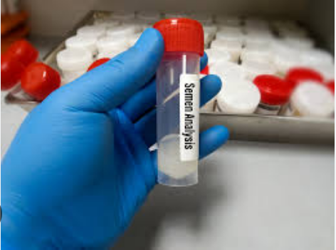 Jinsi ya Kupima Mbegu za Kiume (Sperm Analysis)