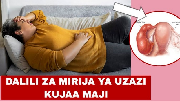 Mirija Ya Uzazi Kujaa Maji