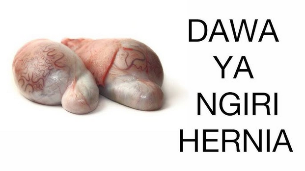Dawa ya ngiri kwa wanaume