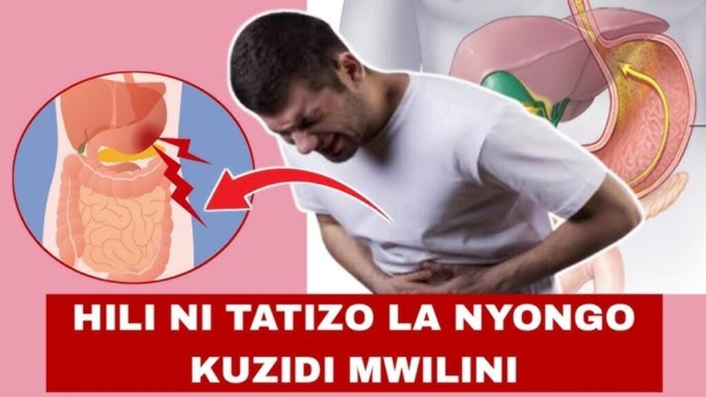 Dalili za nyongo kuzidi mwilini