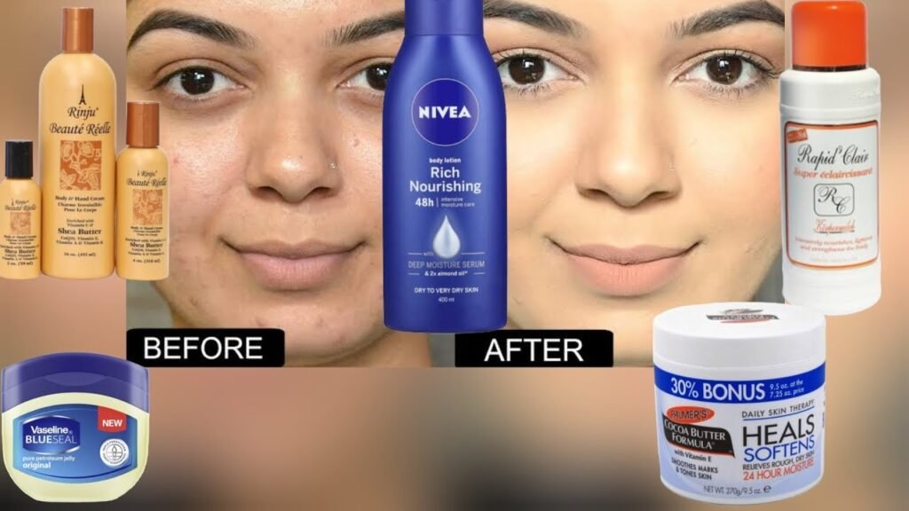 Lotion ya mtu mwenye ngozi ya mafuta