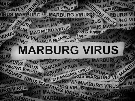 Dalili za Ugonjwa wa Marburg,Sababu,Jinsi ya kujikinga na Tiba yake