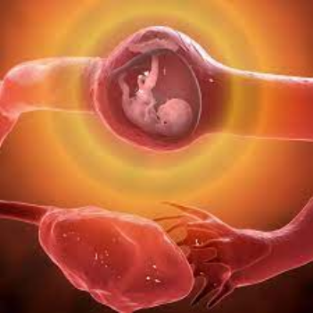 Mimba kutunga kwenye mrija ya Uzazi (ECTOPIC PREGNANCY) Mimba kutunga kwenye mrija ya Uzazi (ECTOPIC PREGNANCY)