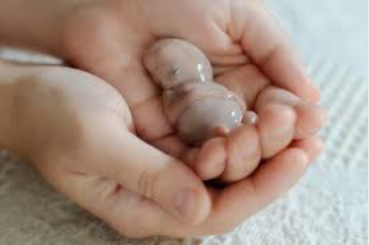 Dalili za mimba kuharibika tumboni (MISCARRIAGE)