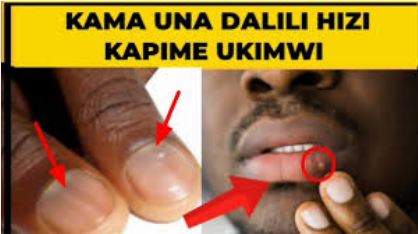 Dalili za Ugonjwa wa Ukimwi kwa Mwanaume, Sababu na Tiba