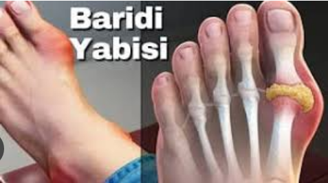 Tiba asili ya baridi yabisi