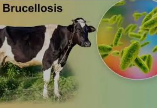 Dalili za Ugonjwa wa Brucellosis, Sababu na Tiba