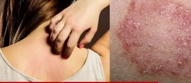 Dalili za mchafuko wa damu mwilini