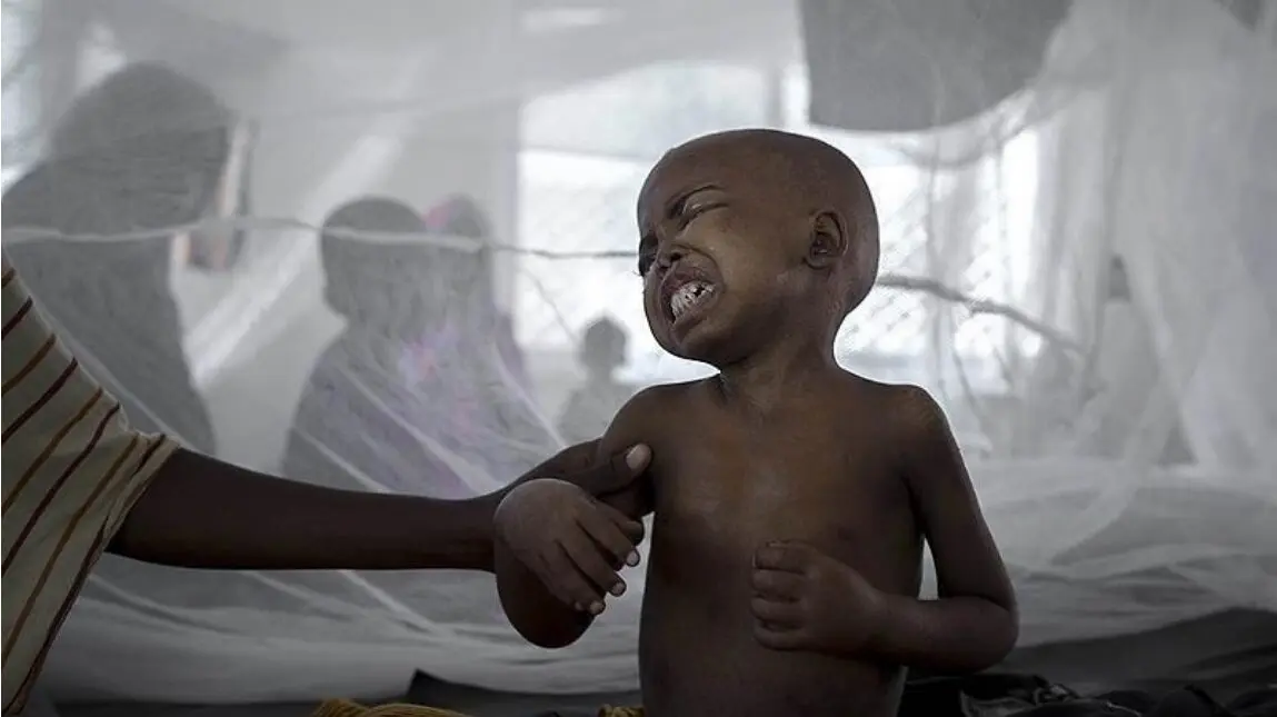 Kuharisha na Kutapika ni Dalili za Ugonjwa Gani? Kuharisha na Kutapika ni Dalili za Ugonjwa Gani?