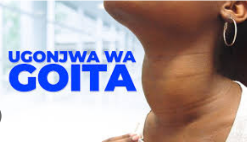 Goita Husababishwa na Nini?