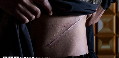 Bei ya figo moja Tanzania