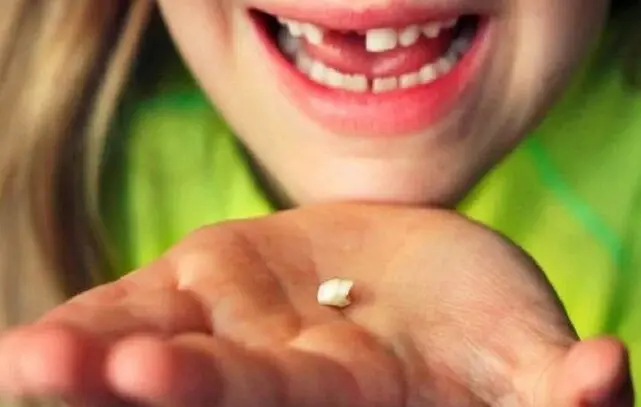 Tafsiri ya ndoto ya kung'oka meno au kuvunjika Jino